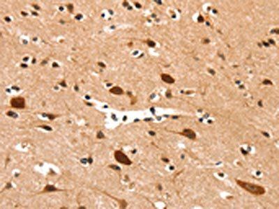 DDX4 Antibody