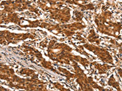 DDX4 Antibody