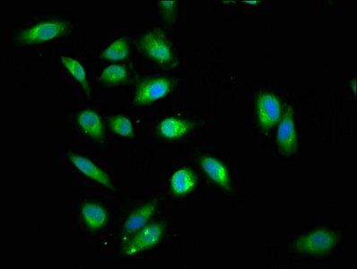 DDX42 Antibody