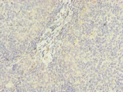DDX42 Antibody