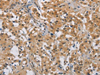 DDX43 Antibody