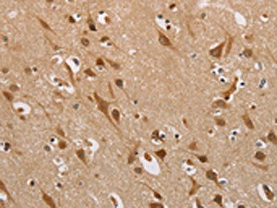 DDX43 Antibody