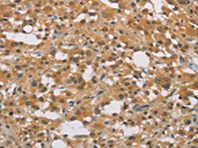 DDX43 Antibody