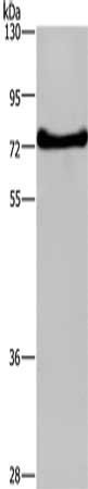 DDX43 Antibody