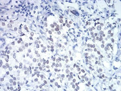 DDX5 Antibody