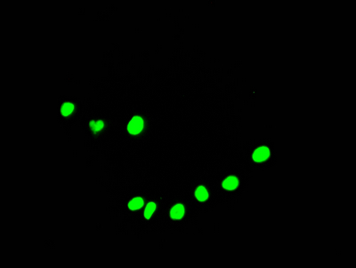 DDX5 Recombinant Monoclonal Antibody