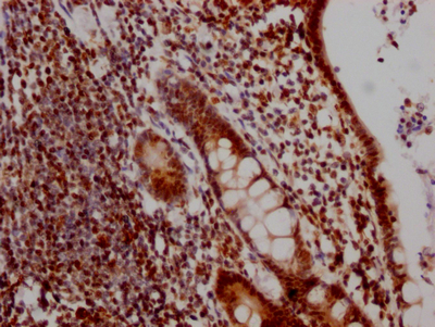 DDX5 Recombinant Monoclonal Antibody