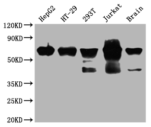 DDX5 Recombinant Monoclonal Antibody