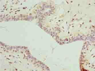 DDX55 Antibody