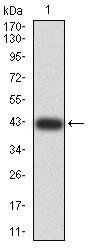 DDX58 Antibody