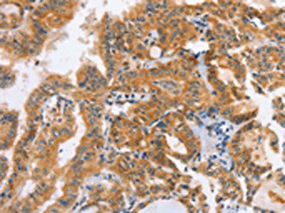 DDX58 Antibody