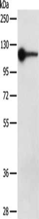 DDX58 Antibody