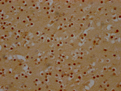 DDX6 Antibody