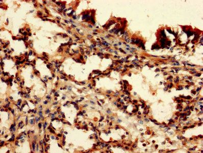 DAP Antibody