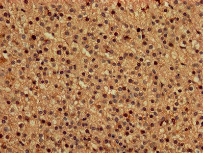 DAP Antibody