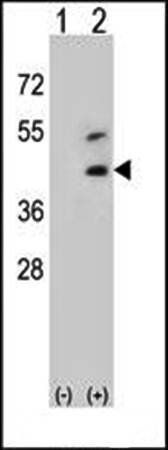 Decorin antibody
