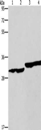 DECR1 antibody