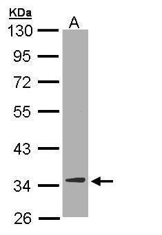 DECR1 antibody [N1C3]