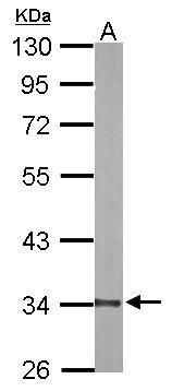 DECR1 antibody [N1C3]