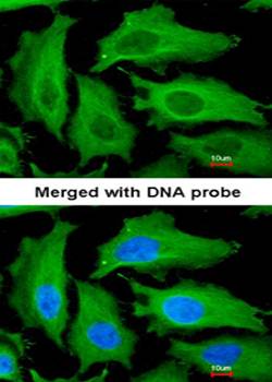 DECR1 antibody