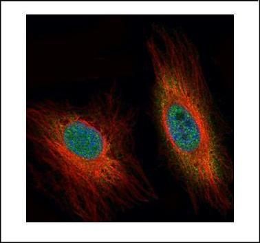 NADH:ubiquinone oxidoreductase subunit B5 Antibody