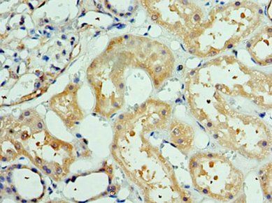DEDD2 Antibody