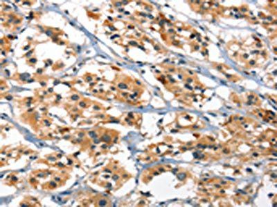 DEFA1/DEFA3 Antibody