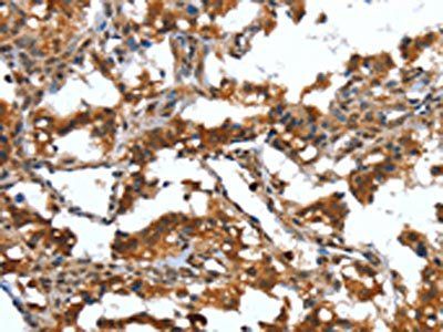 DEFA4 Antibody