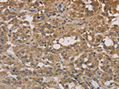 DEGS1 Antibody