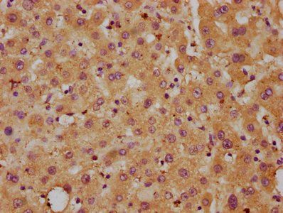 DLL3 Antibody