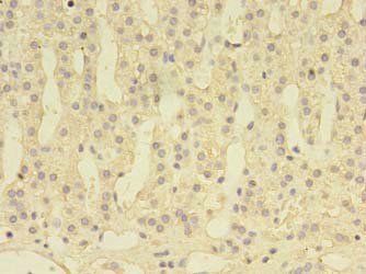 DENND1A Antibody