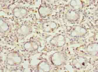 DENND5A Antibody