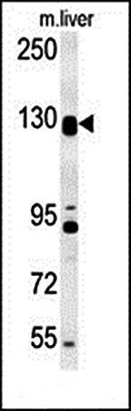 DENND5B antibody