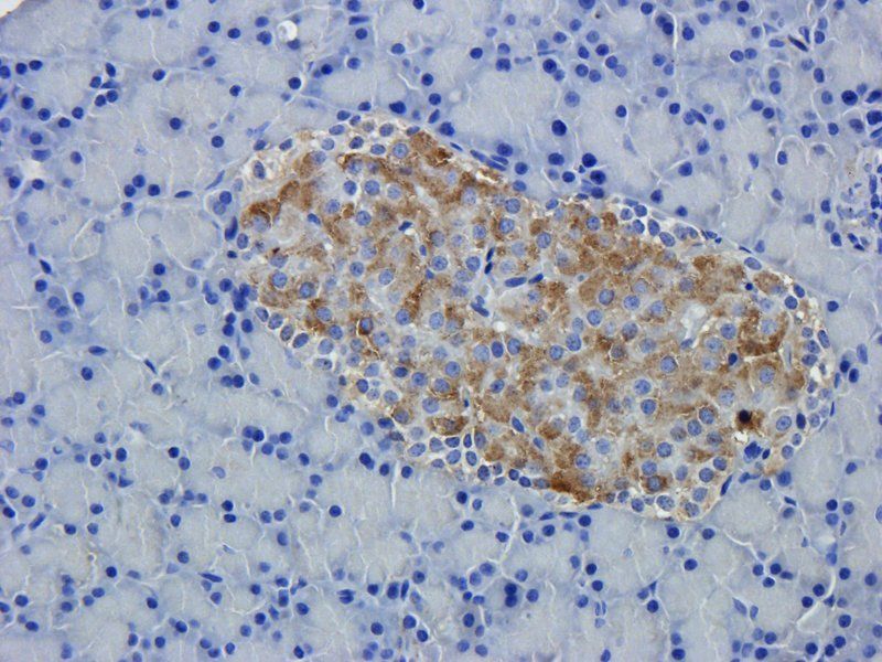 DEPDC1 antibody