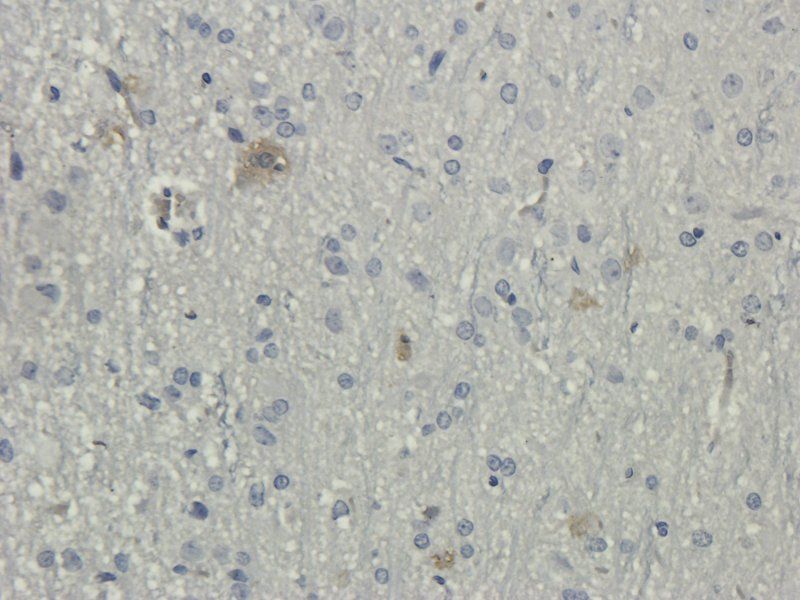 DEPDC1 antibody