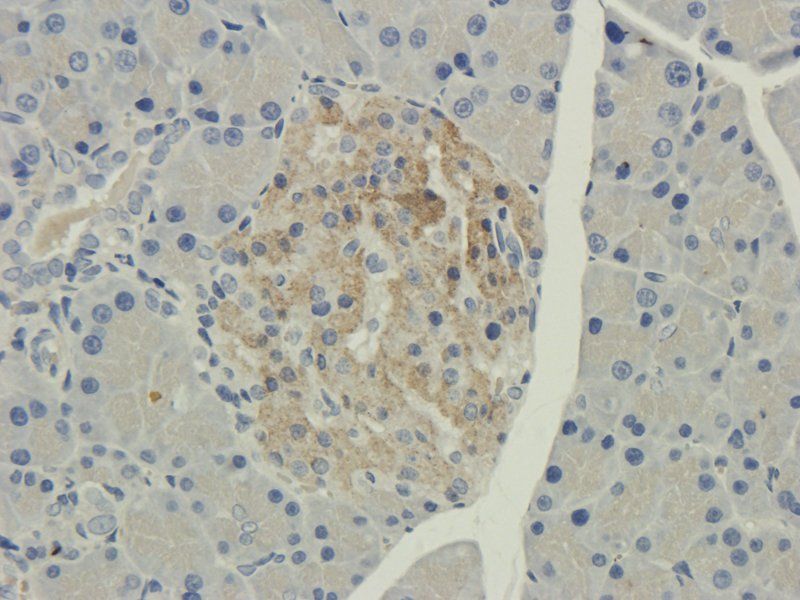 DEPDC1 antibody