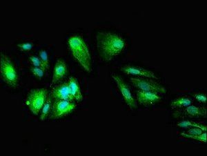 DEPDC1B Antibody