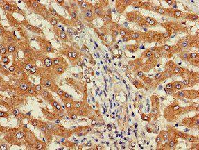 DEPDC1B Antibody