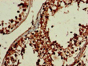 DEPDC1B Antibody