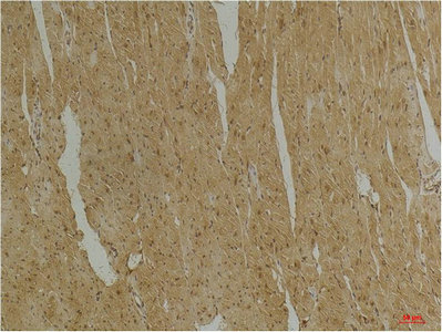 DES Antibody