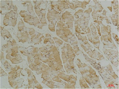 DES Antibody