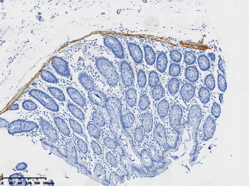Desmin Antibody