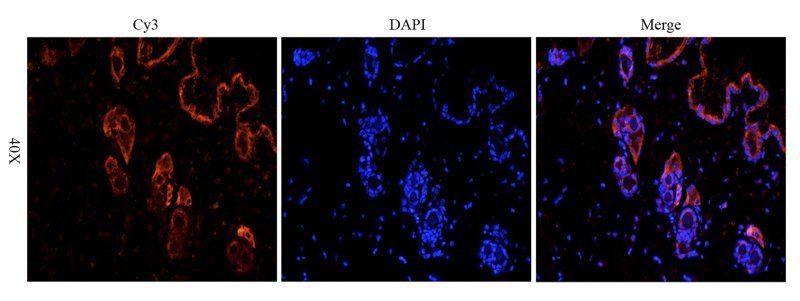 Desmocollin 1 antibody