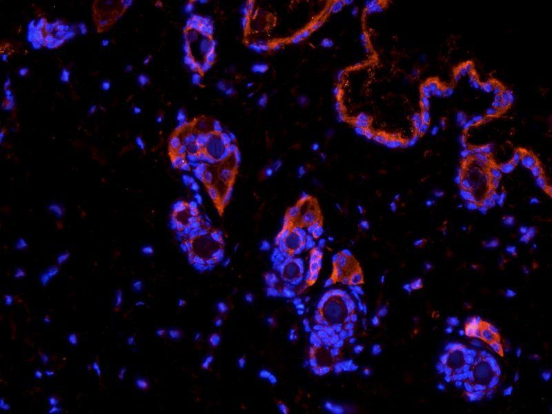 Desmocollin 1 antibody