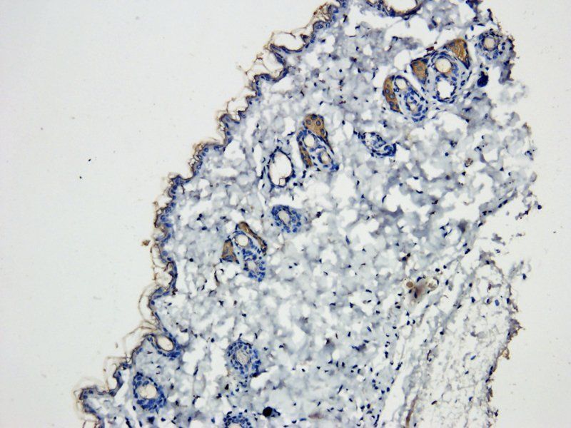 Desmocollin 1 antibody