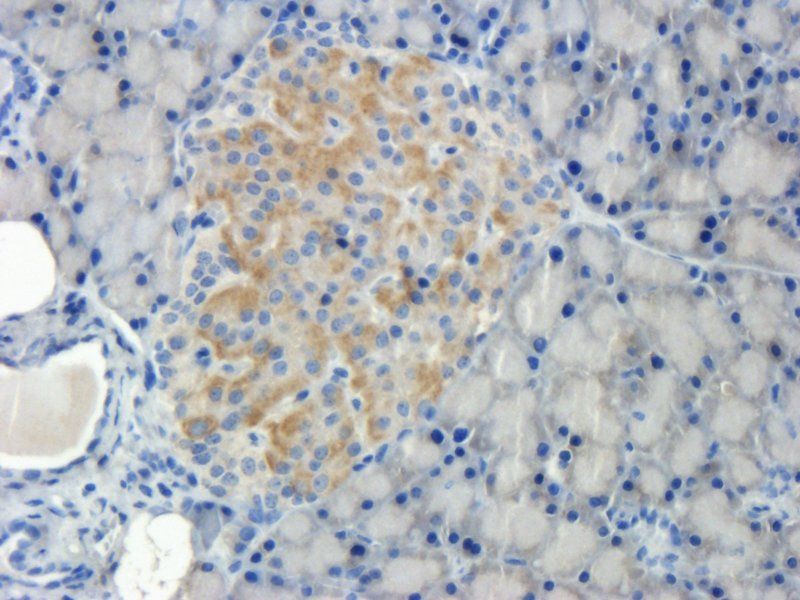 Desmocollin 1 antibody