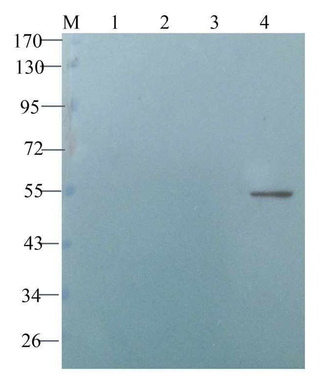 Desmocollin 1 antibody