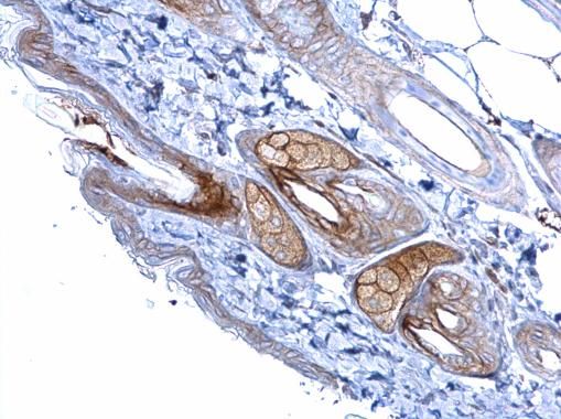 Desmoglein 2 antibody [N1N2], N-term
