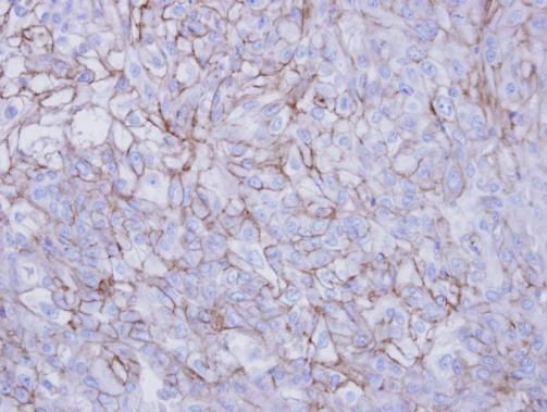 Desmoglein 2 antibody [N1N2], N-term