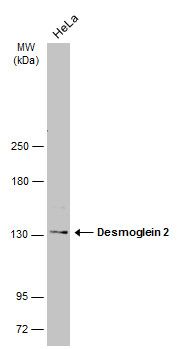 Desmoglein 2 antibody